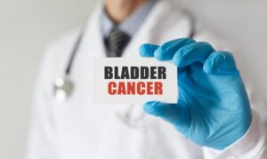 Facts-About-Bladder-Cancer